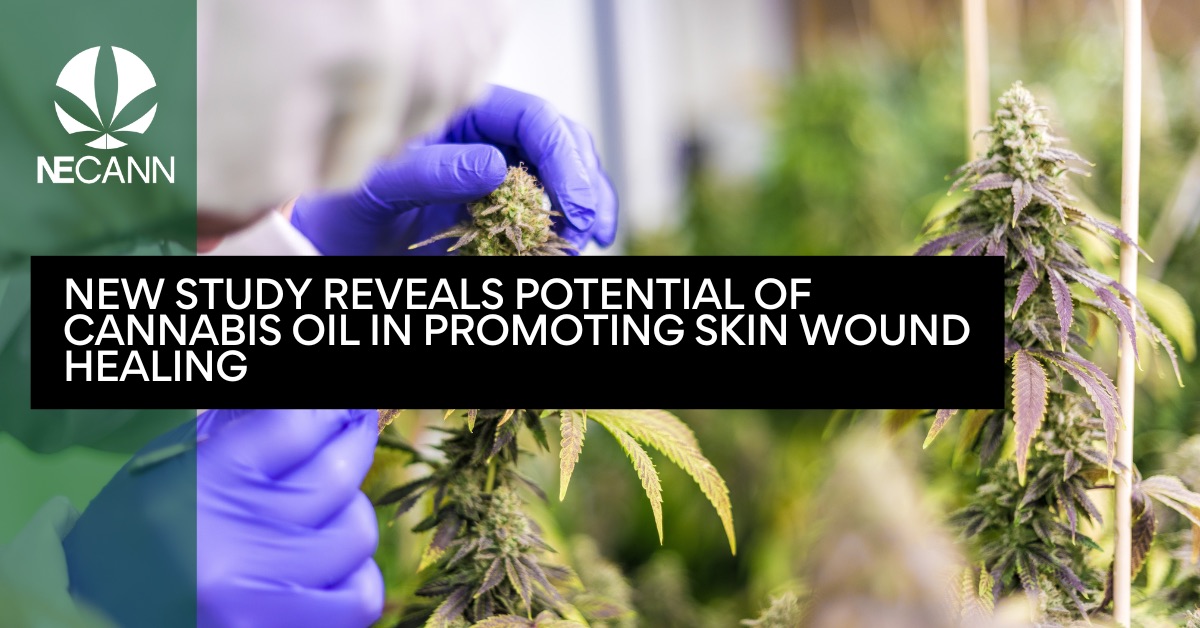 Study Highlights Cannabis Oil’s Healing Potential